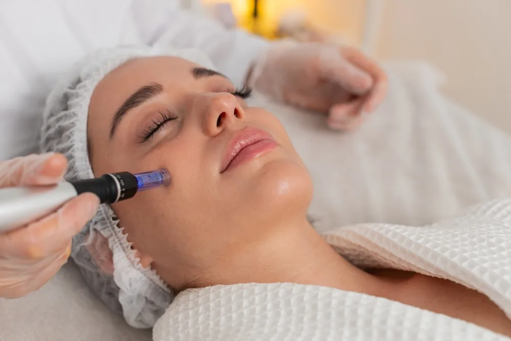 Microneedling Los Gatos, California Banner