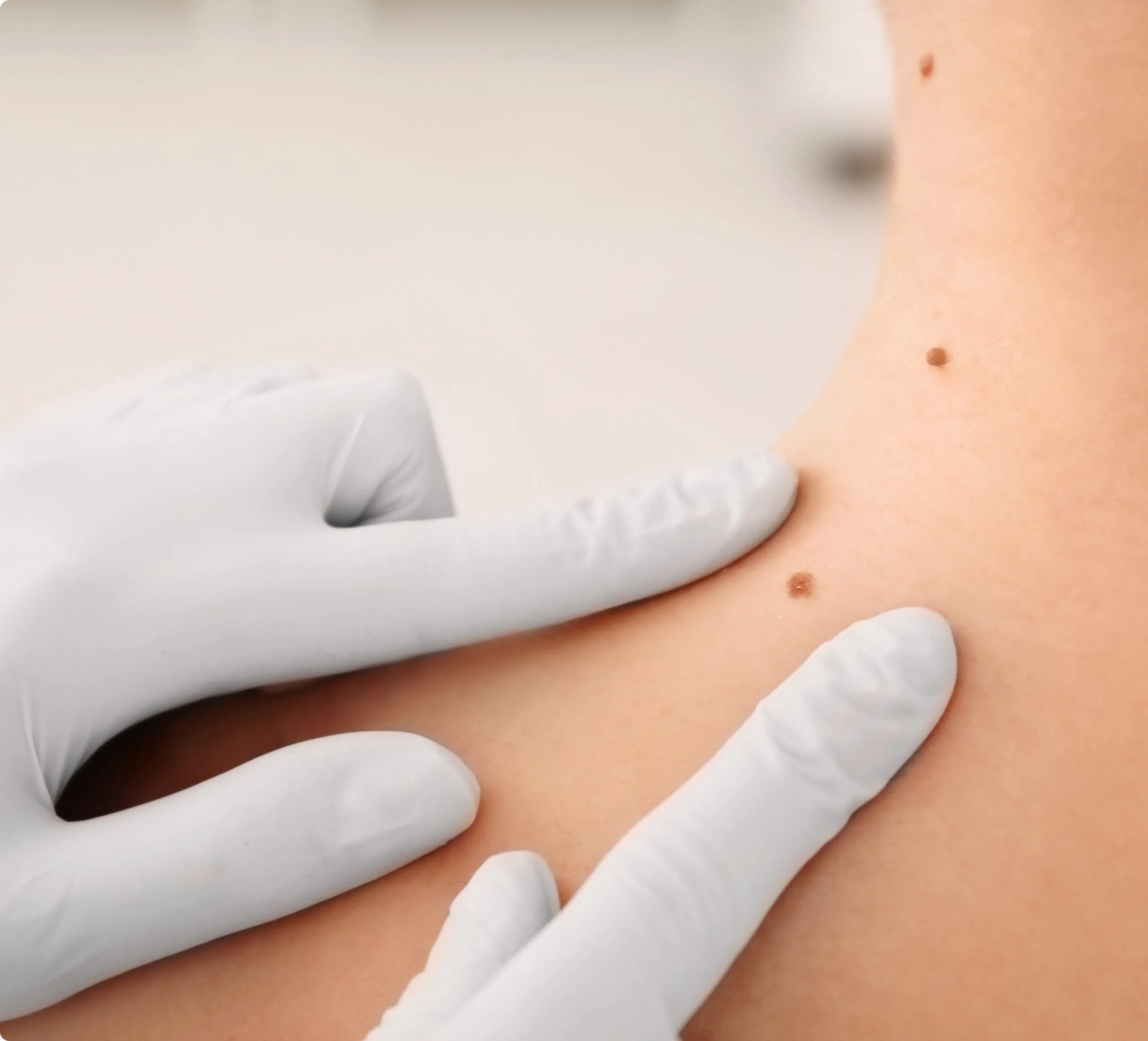 Skin Treatments Los Gatos, California Banner