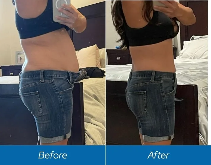 Before and after weight loss results showing abdominal and torso definition