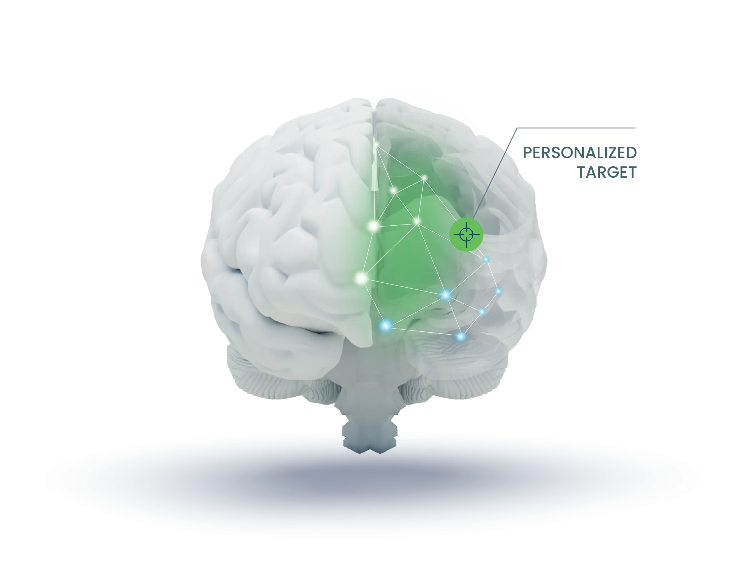 Brain diagram with green neural network overlay highlighting personalized target area