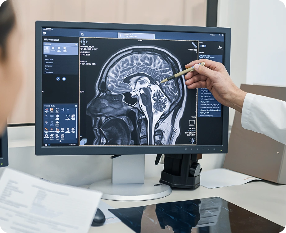 Healthcare professional pointing to brain MRI scan displayed on computer monitor