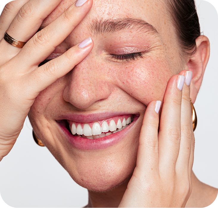 Person smiling with hands touching face, displaying bright white teeth