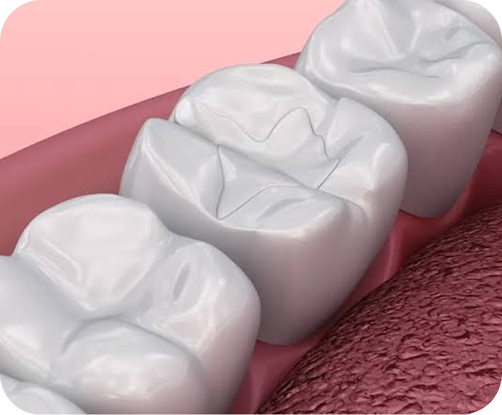 Three white dental crowns displayed on a pink and red textured surface
