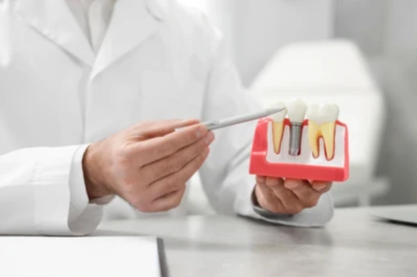 Oral surgeon pointing to dental implant model showing tooth replacement options