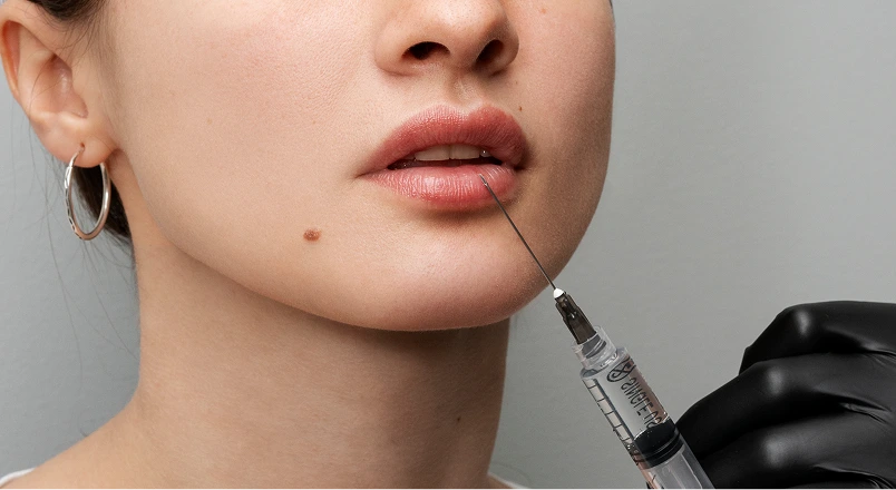 Gloved hand holding syringe to woman's chin for dermal filler injection