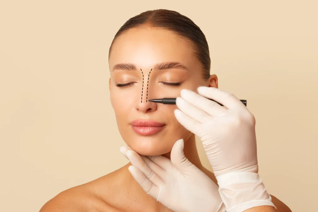 Does Insurance Cover Rhinoplasty? Banner
