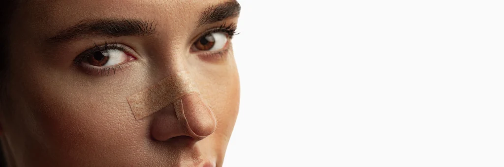 How Long Does Rhinoplasty Take to Heal? Banner