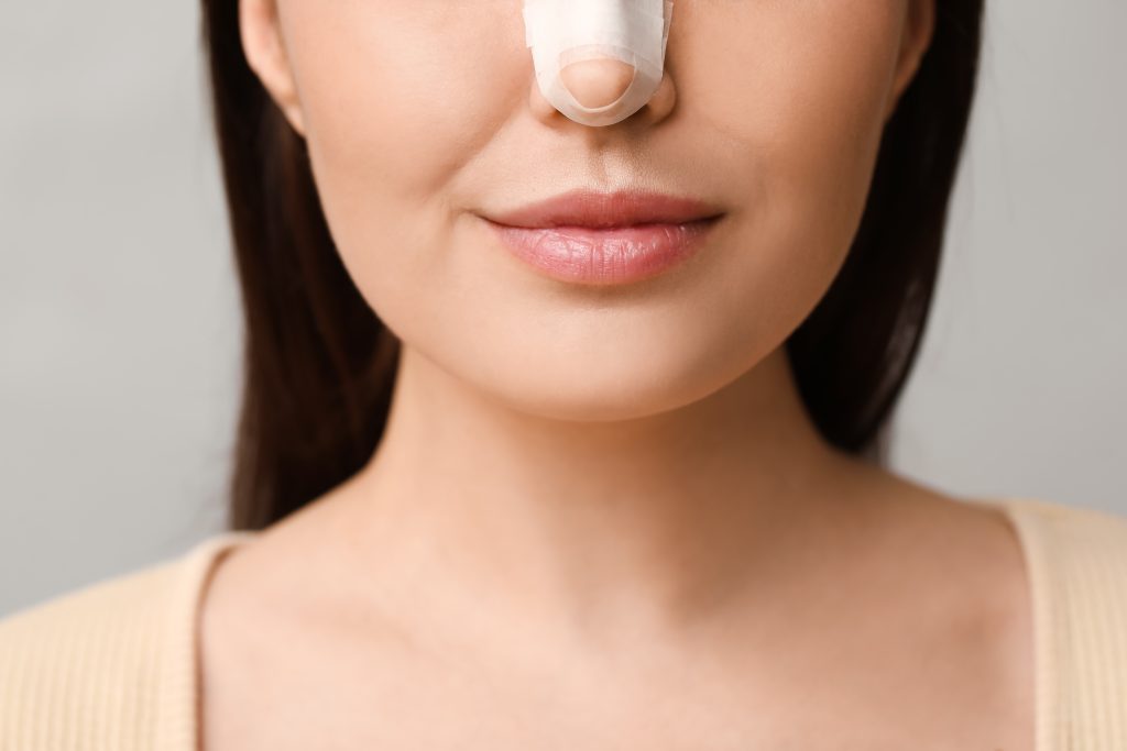 What Happens in the Rhinoplasty Recovery Timeline By Week? banner