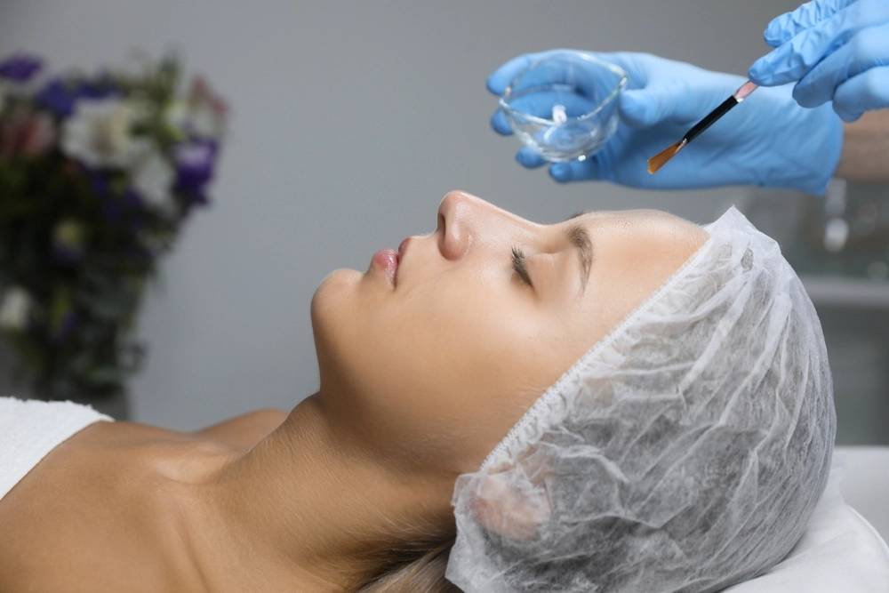 Aesthetician applying blue chemical peel solution to patient's face with brush