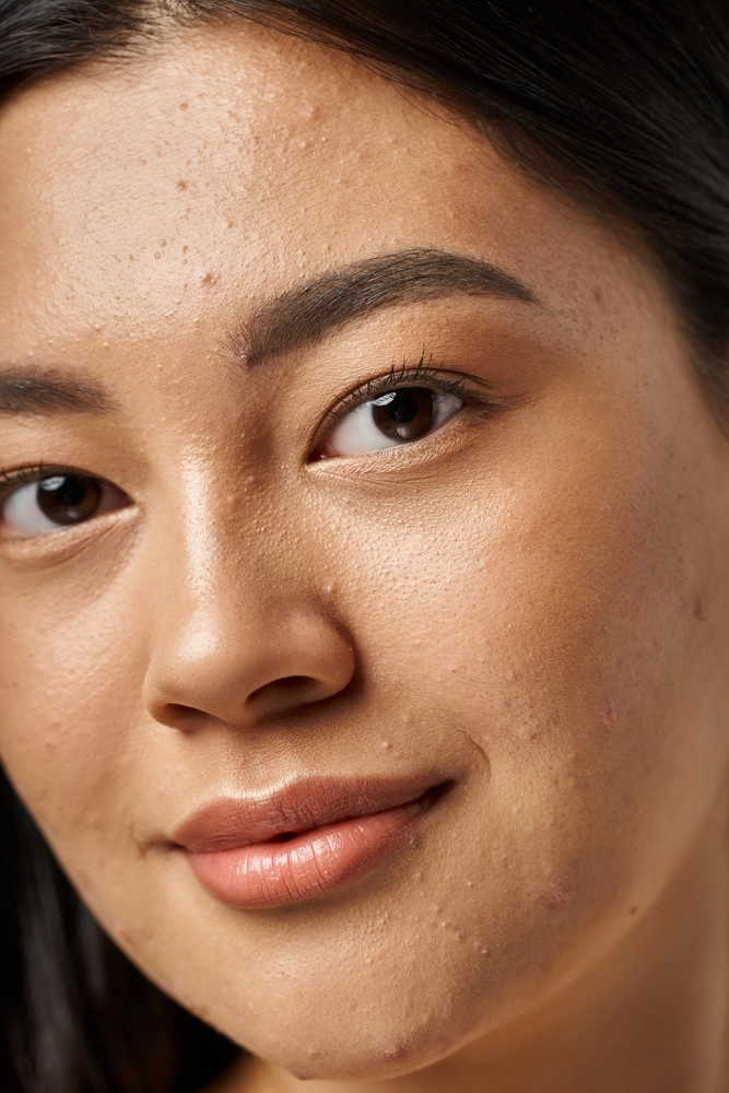 Close-up of person's face showing skin texture and complexion