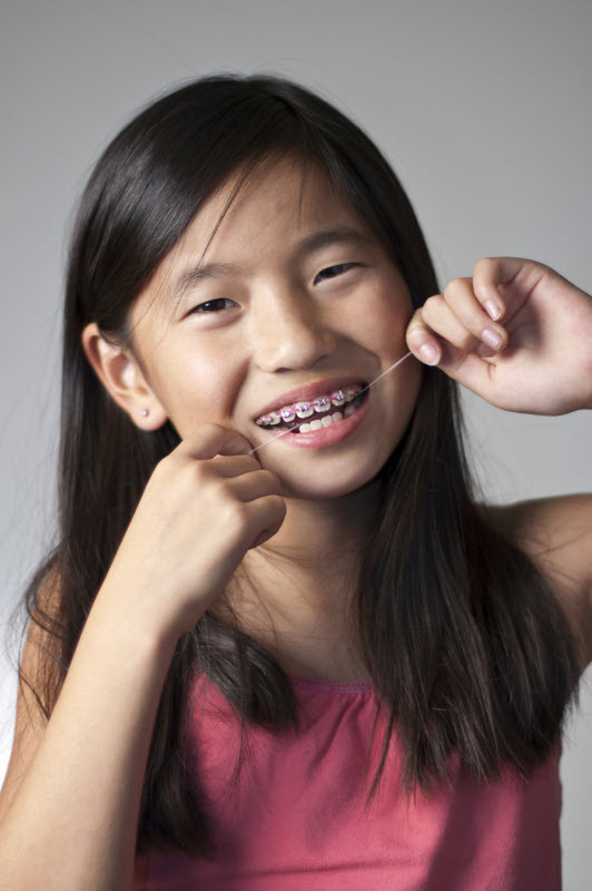 Misconceptions about flossing 
