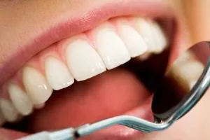mouth checkup | Advanced Dentistry of Collegeville