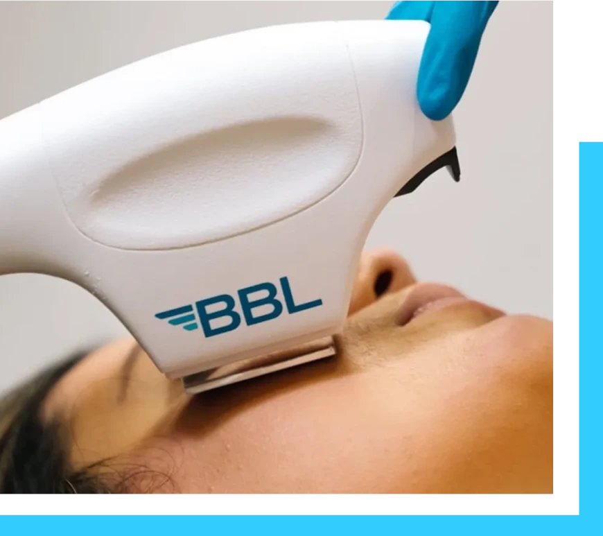 Laser Treatment Englewood Cliffs, NJ: BBL Forever Bare Banner