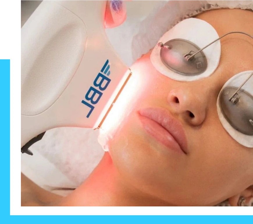 Englewood Cliffs, NJ Laser Treatment: BBL Forever Young Banner