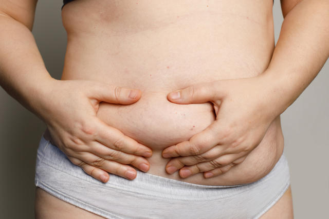 Am I a Good Candidate for Mini Tummy Tuck Surgery? banner