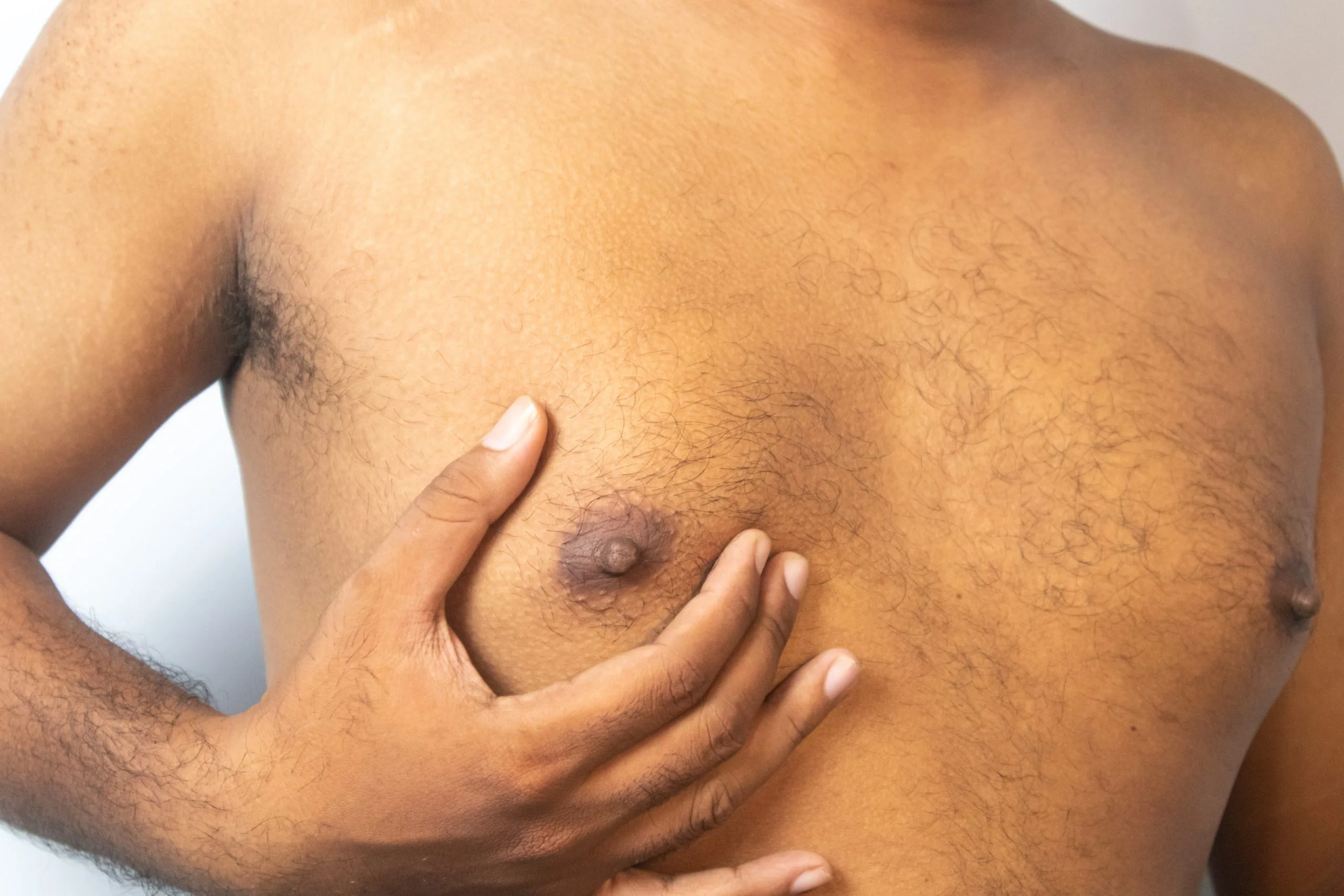 What Causes Gynecomastia and How Is It Treated? Banner