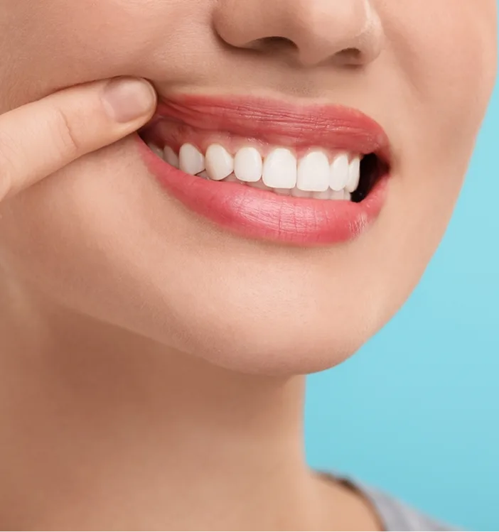 Person pointing to red, inflamed gum tissue above upper teeth