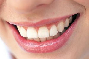 Close-up of person's smile showing healthy, white teeth and pink lips