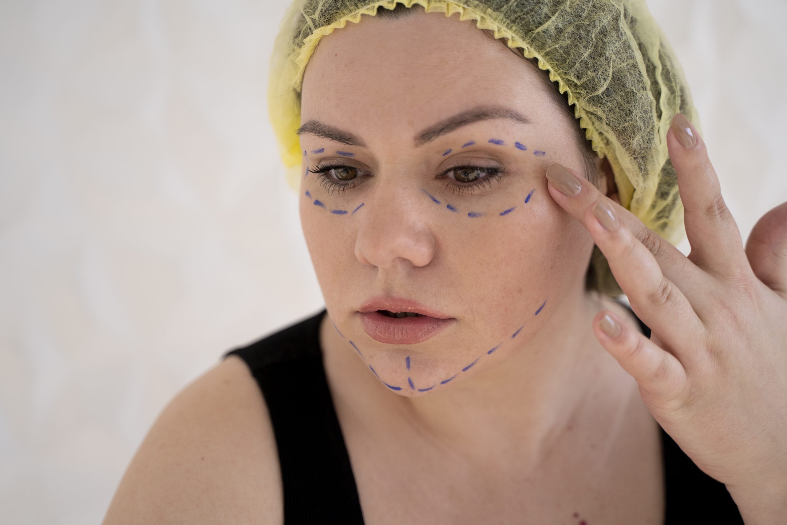 Fotona Laser Non-Surgical Facelift Banner