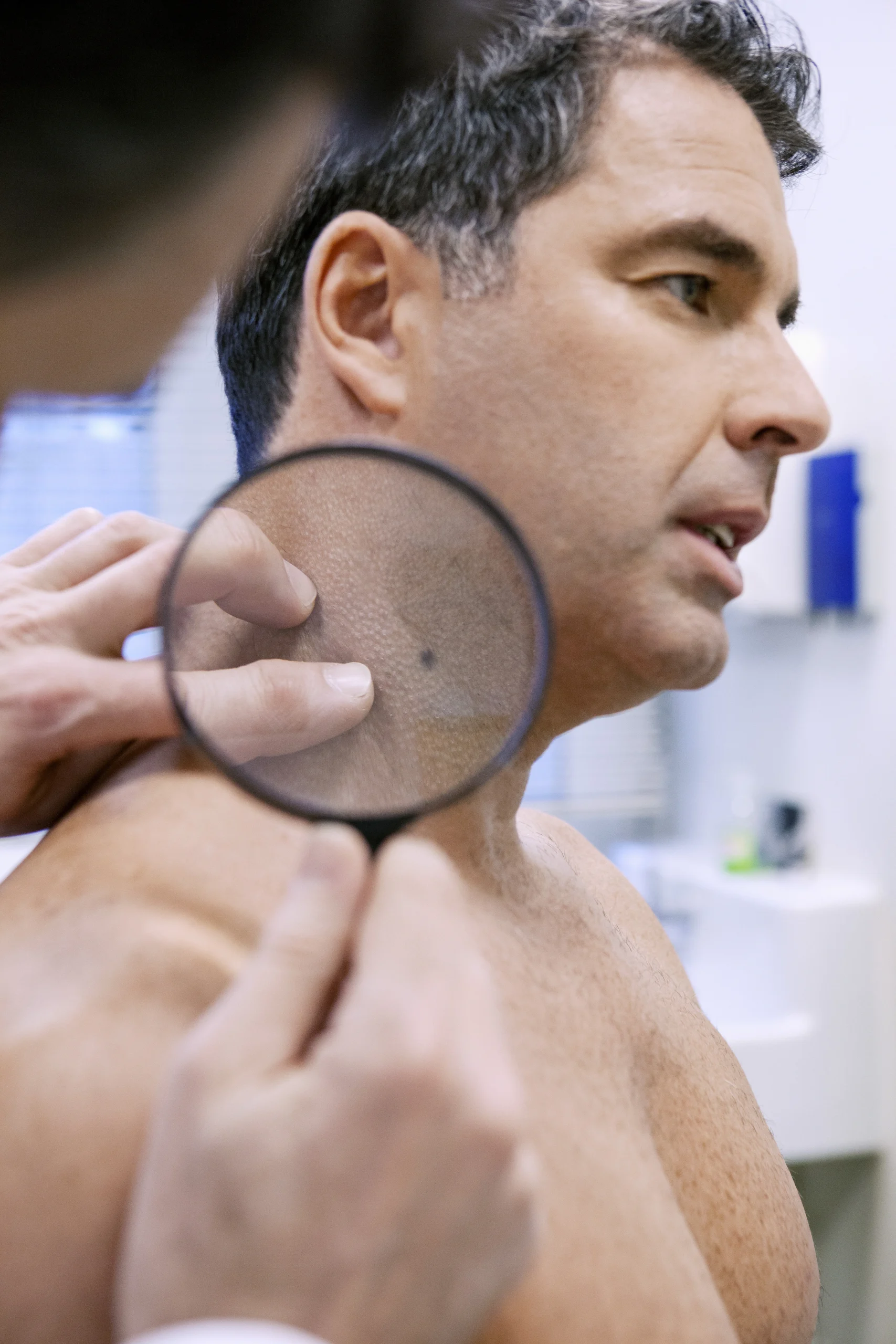 Dermatologist examining a patient's skin lesion with magnifying glass during consultation
