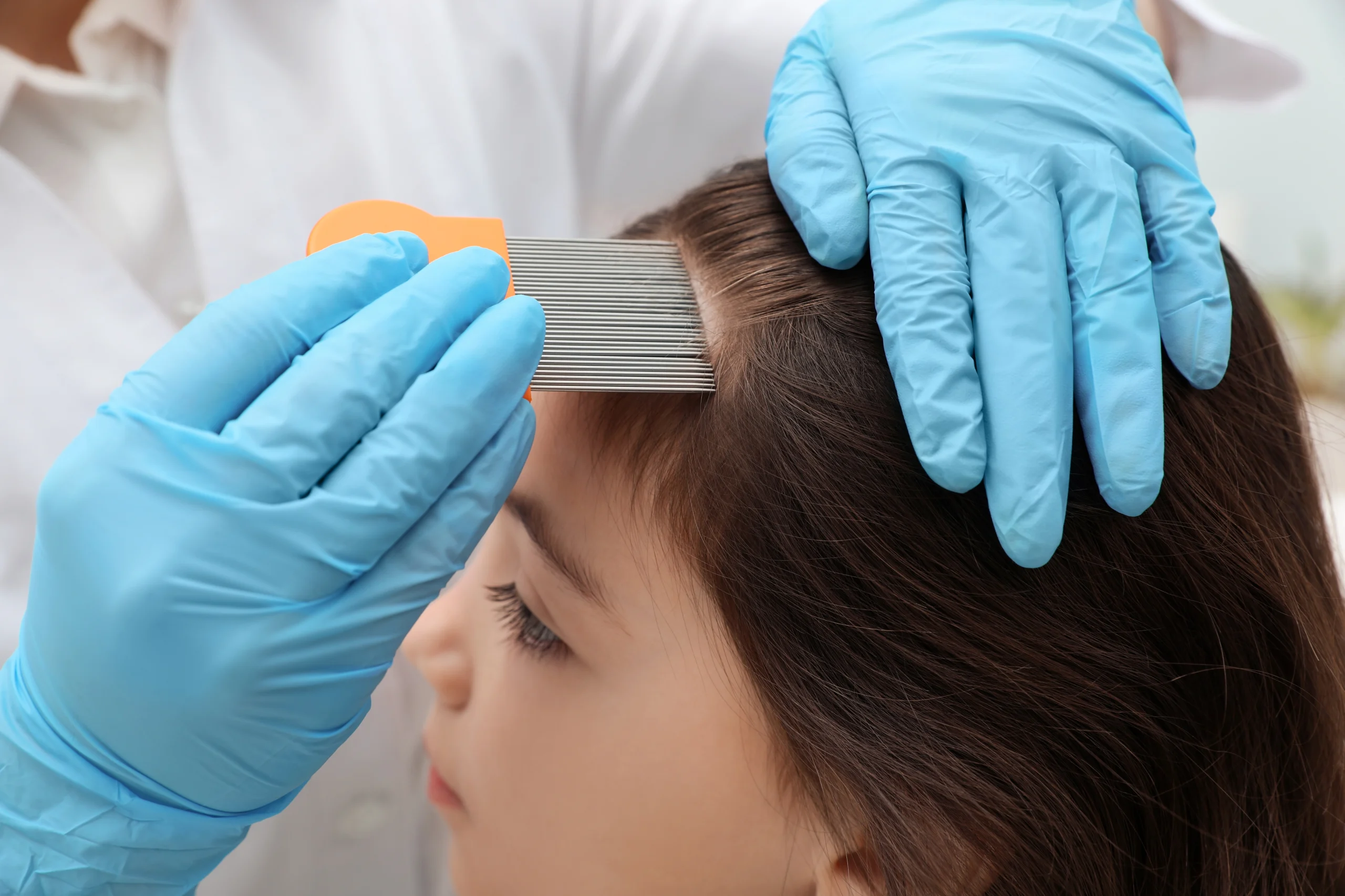 Healthcare provider in blue gloves using a fine-tooth comb to examine a child's hair for lice