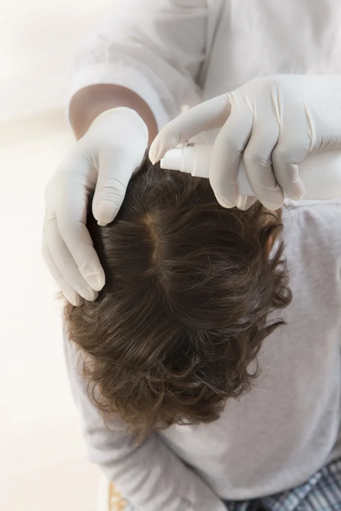 Healthcare provider in gloves examining scalp and hair for head lice infestation