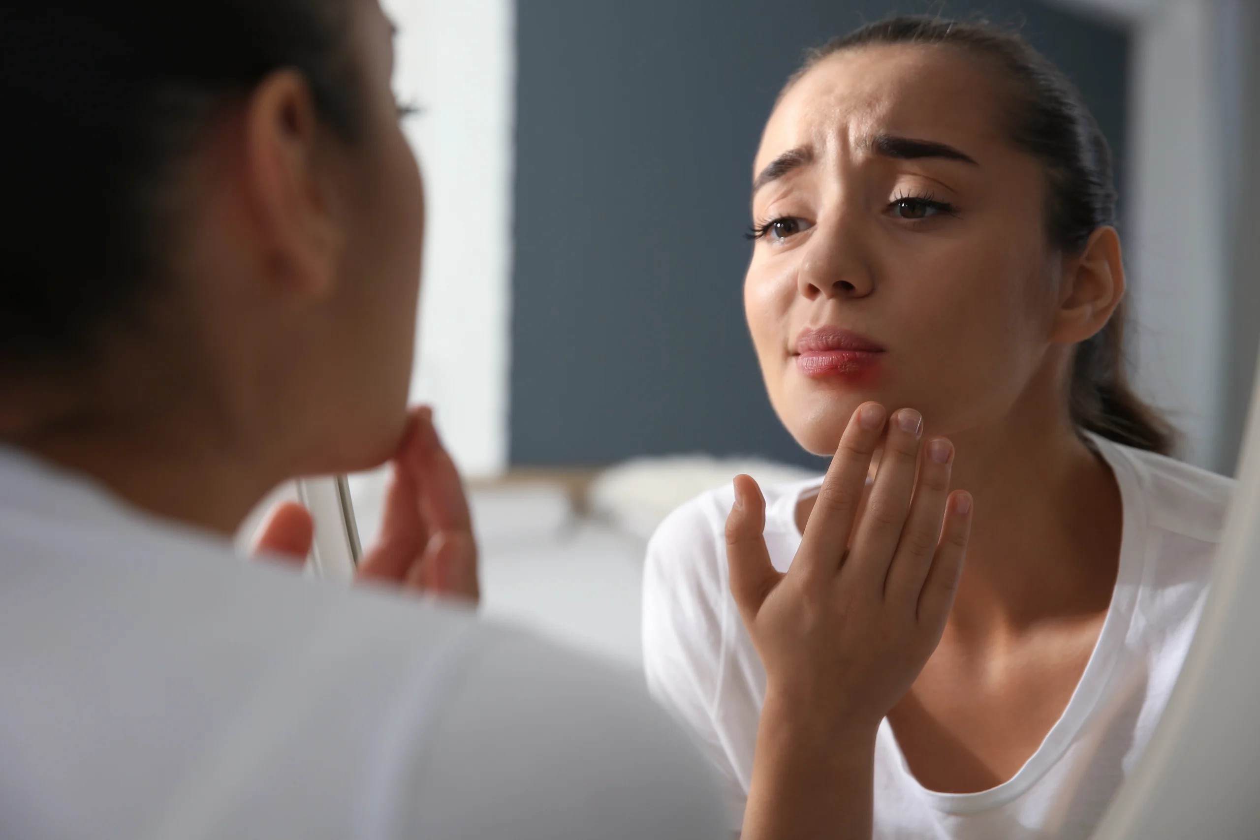 Woman examining her lip in a mirror, concerned about a skin condition