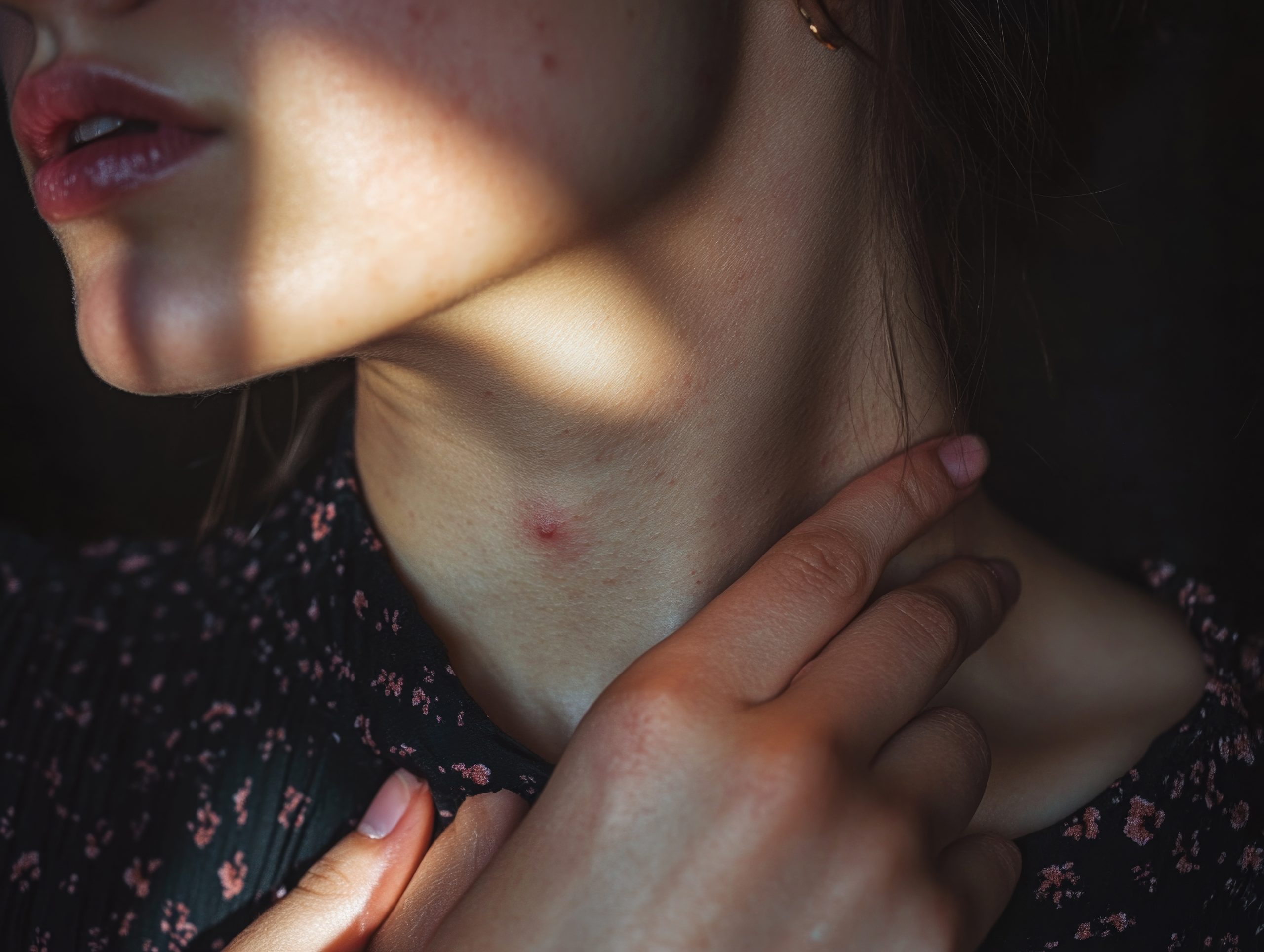 Woman touching her neck where a boil is visible on the skin