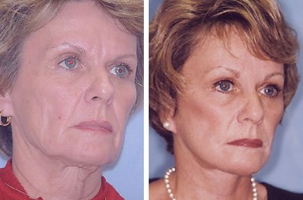 facejuv22