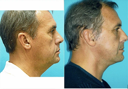 facejuv28