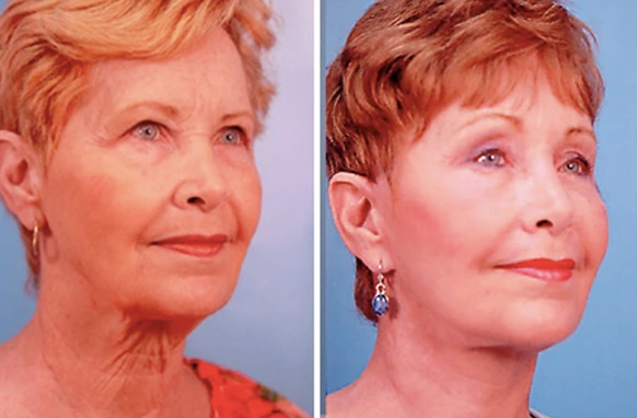 facejuv3