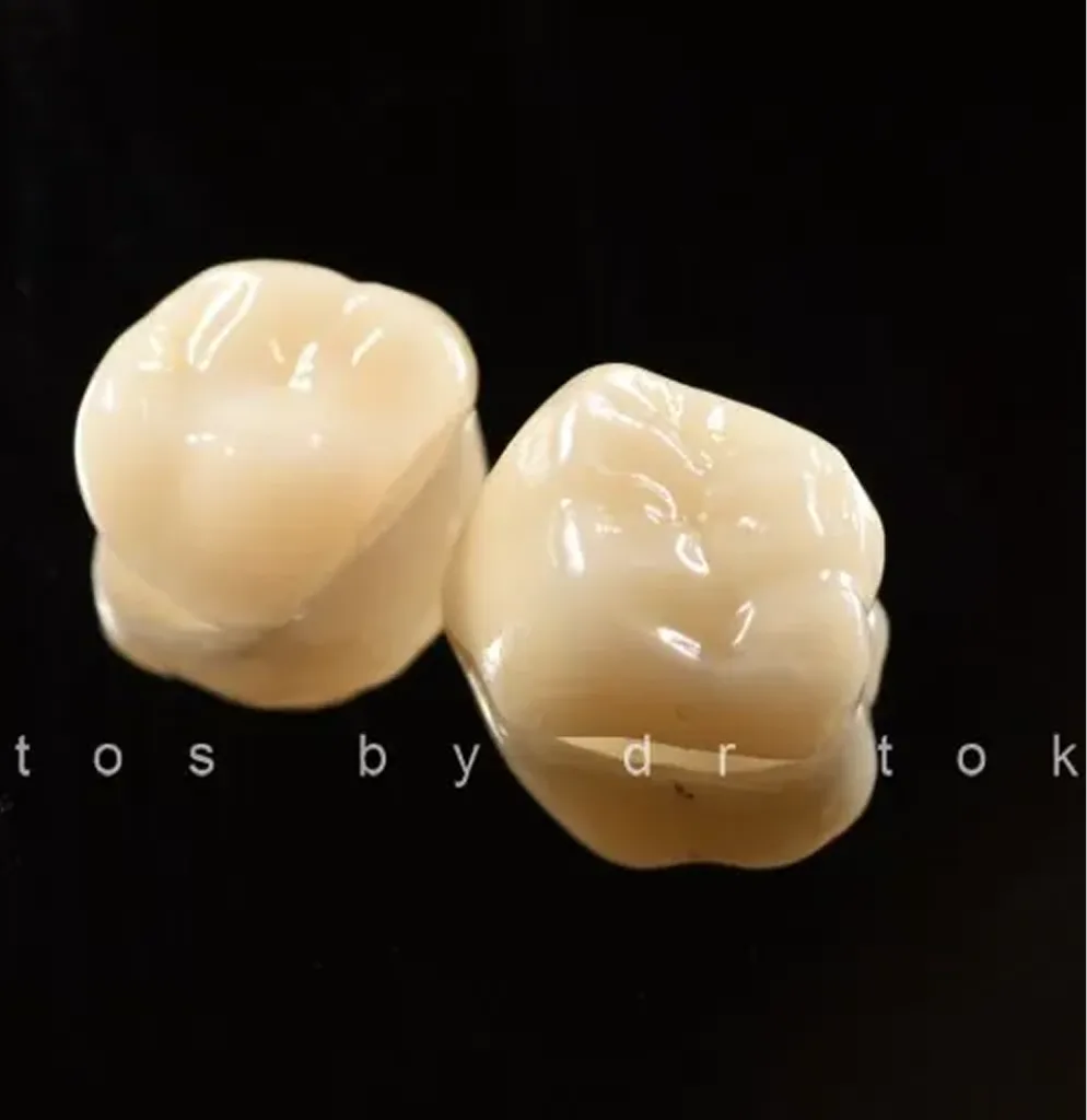 Two natural-colored dental crown restorations on black background