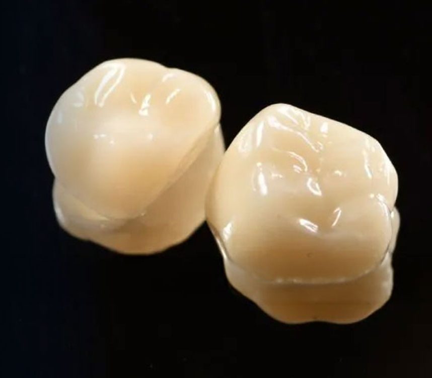 Two ceramic dental crowns displayed against dark background