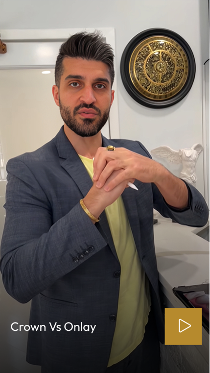 Man in dental office holding a tooth model while comparing crowns versus onlays
