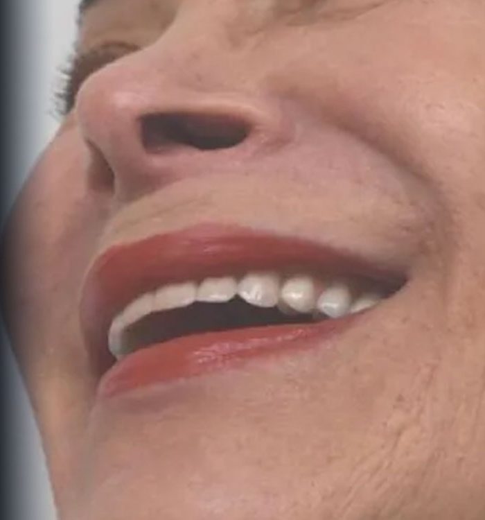 Person smiling showing natural-looking teeth from dental implant restoration