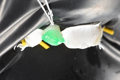 ICON white spot treatment being applied to a tooth with a handheld device