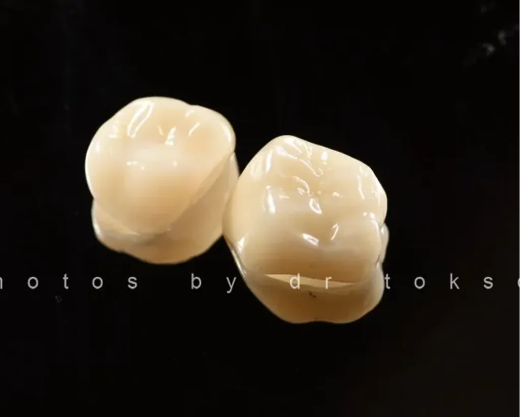 Two tooth-colored porcelain crowns displayed against black background