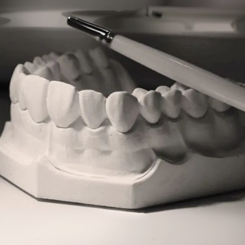 Dental technician using brush to examine veneer restorations on tooth model