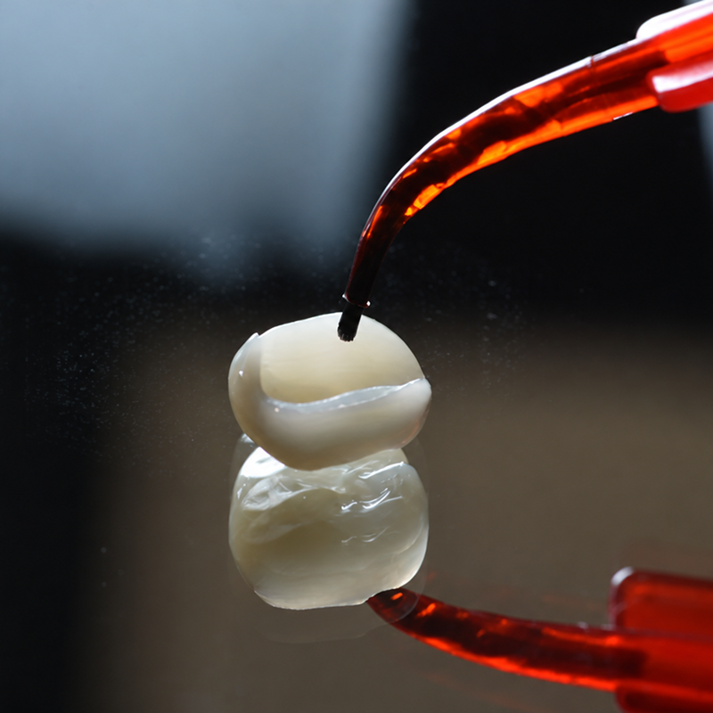 Dental curing light illuminating ceramic crown restoration during placement