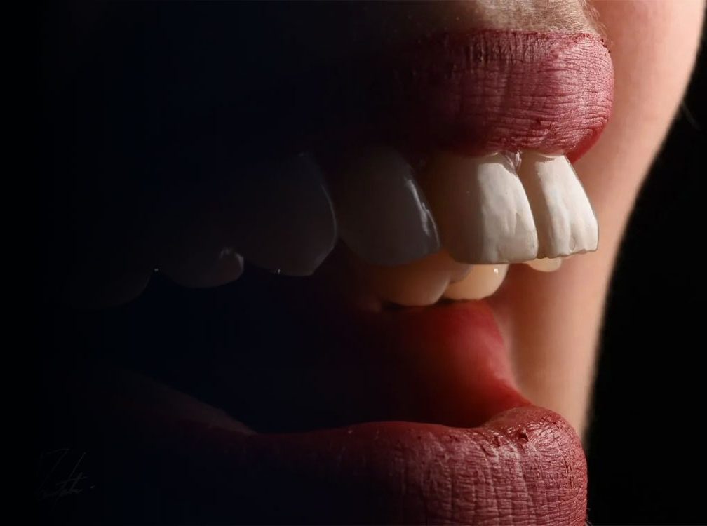 Profile view of patient displaying white upper front teeth against dark background