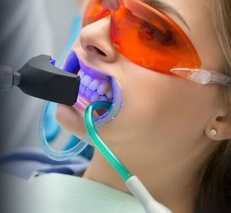 Patient wearing LED whitening tray and protective orange eyewear during professional teeth whitening treatment