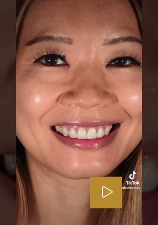 Woman smiling showing teeth with play button overlay