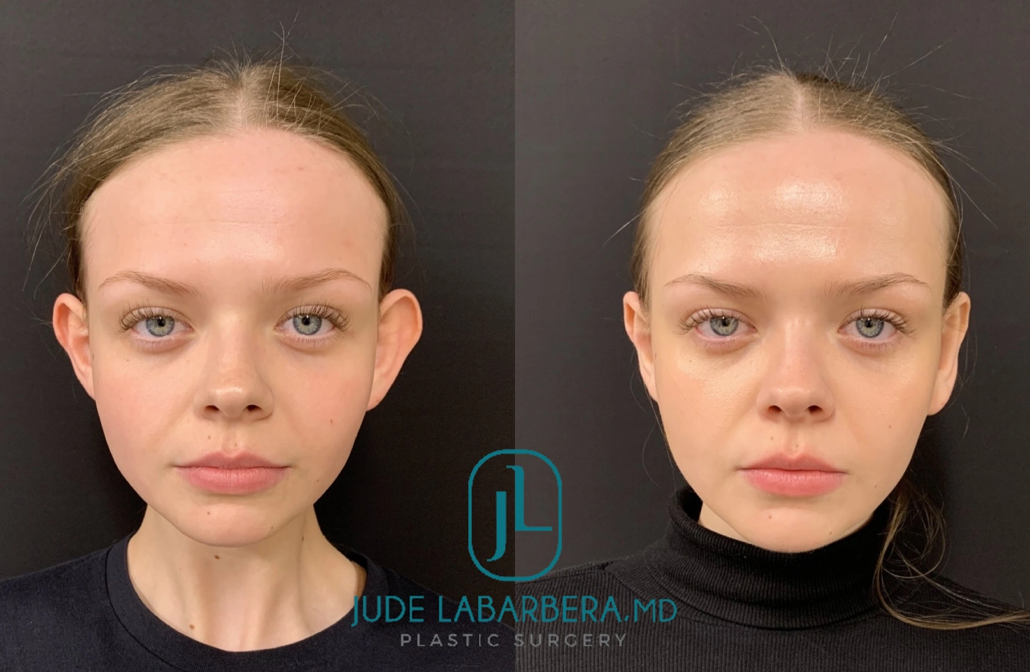 eZy Watermark_04-03-2024_11-45-31-1760AM