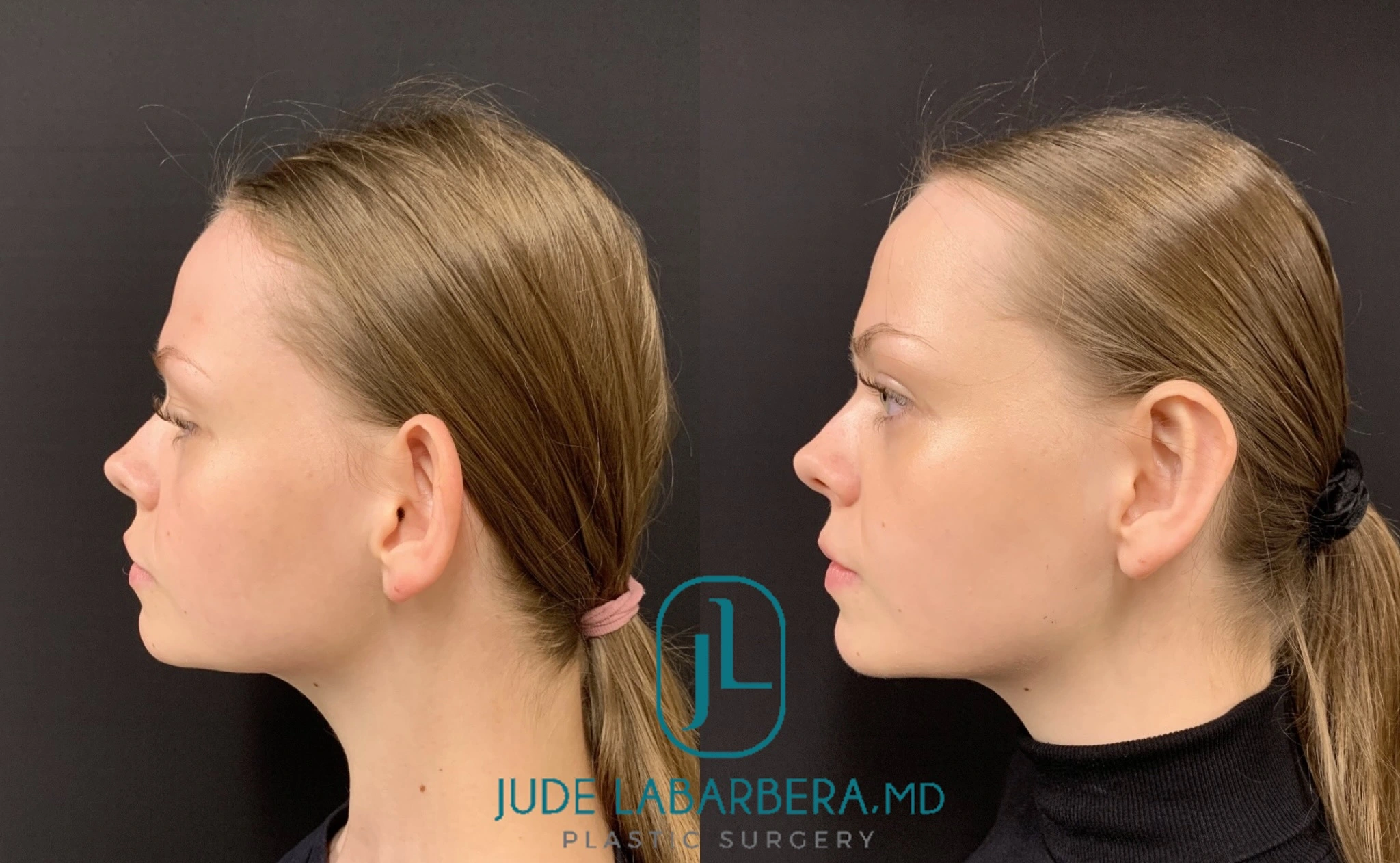 eZy Watermark_04-03-2024_11-45-55-2030AM