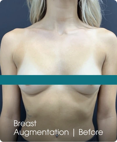 Jude LaBarbera MD Plastic Surgery of Scottsdale