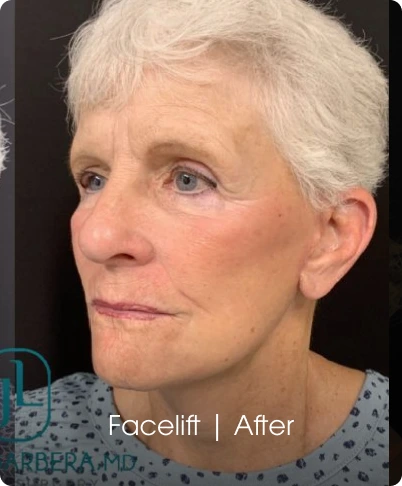 Jude LaBarbera MD Plastic Surgery of Scottsdale
