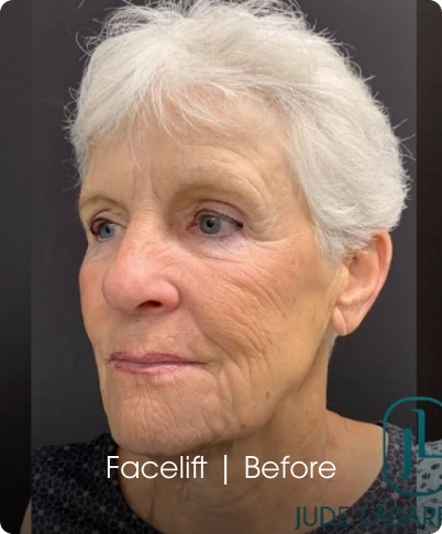 Jude LaBarbera MD Plastic Surgery of Scottsdale
