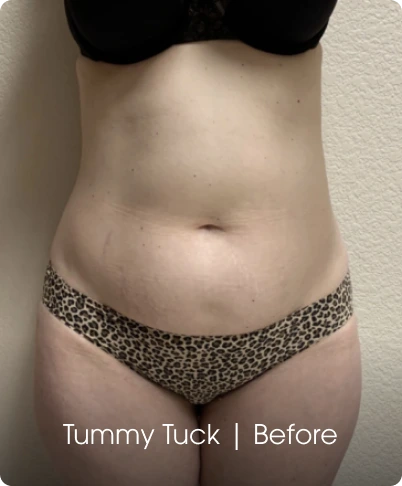 Jude LaBarbera MD Plastic Surgery of Scottsdale