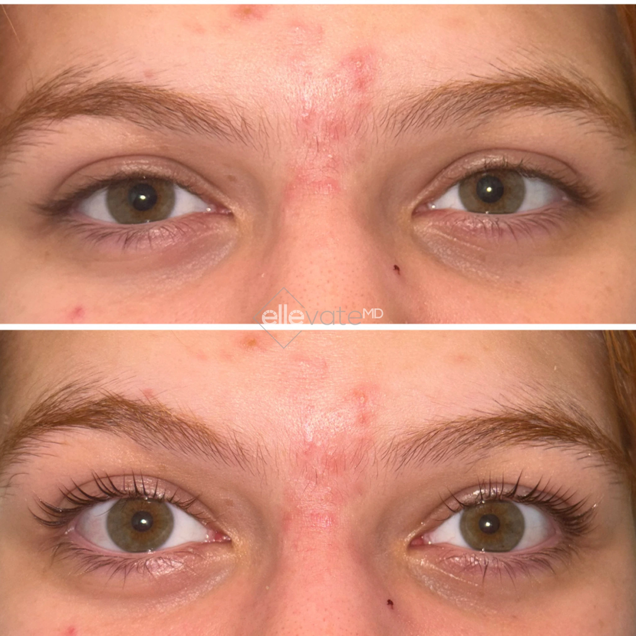 Case 13 before and after