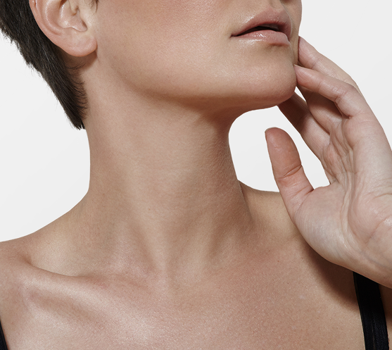 Woman touching her neck and jawline area demonstrating necklift results